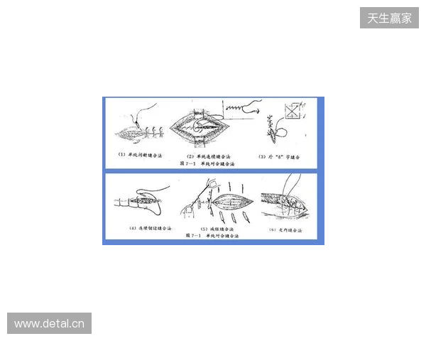 广州豹官方:杨浩眉弓伤口缝合30余针,预计5-7天后拆线 广州豹官方:杨浩眉弓伤口缝合30余针,预计5-7天后拆线